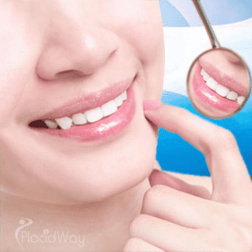 So kombinieren Sie einen luxuriösen Frankreichurlaub mit erschwinglicher Zahnbehandlung in der Türkei